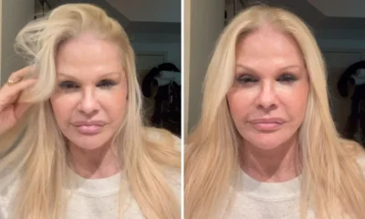 Monique Evans fica em choque com resultado de cirurgia.webp