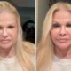 Monique Evans fica em choque com resultado de cirurgia.webp