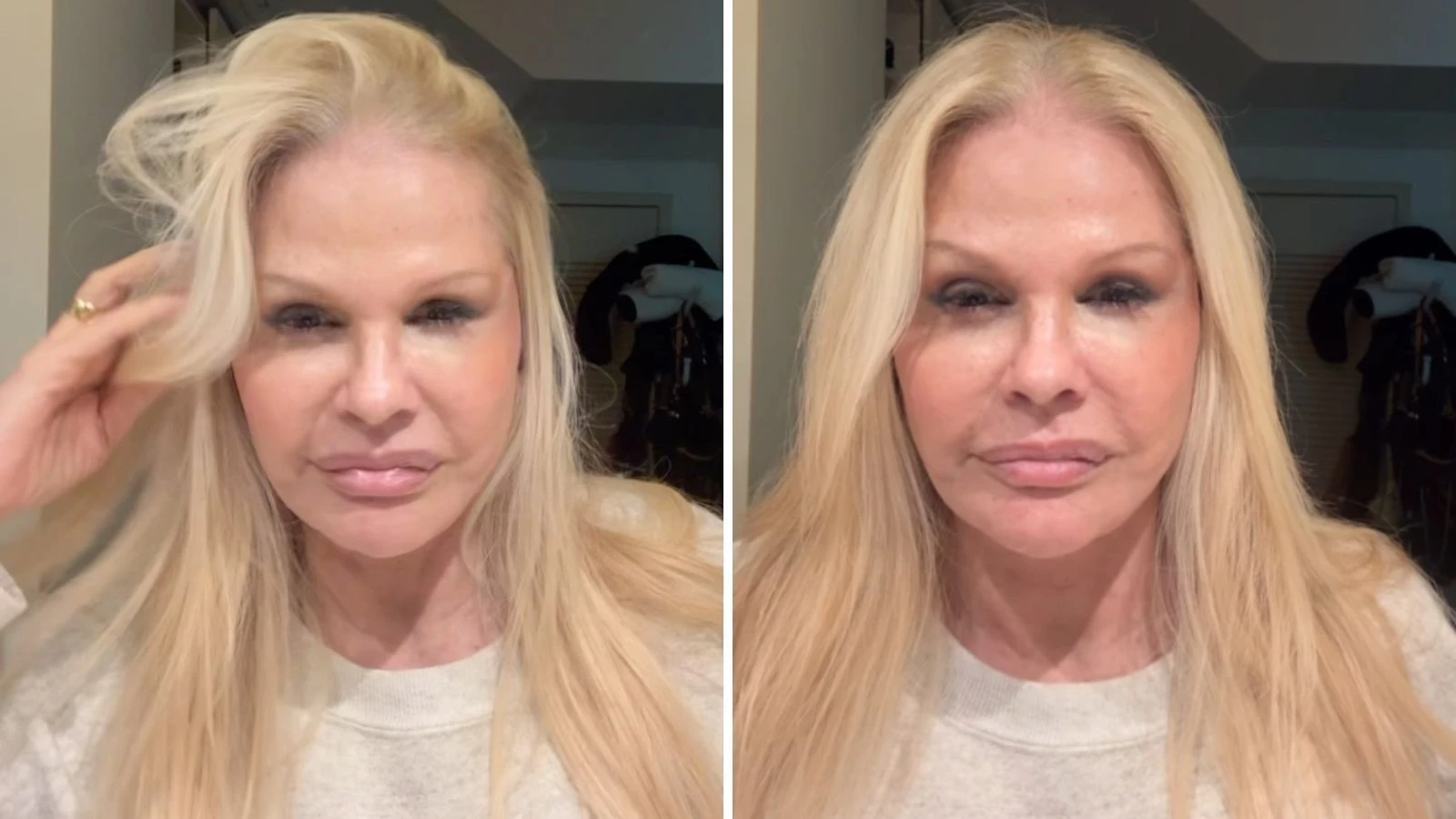 Monique Evans fica em choque com resultado de cirurgia.webp
