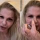 Monique Evans mostra rosto sete dias apos cirurgia plastica Estou
