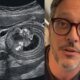 Motivo revelado por que Lucio Mauro Filho escondeu o diagnostico