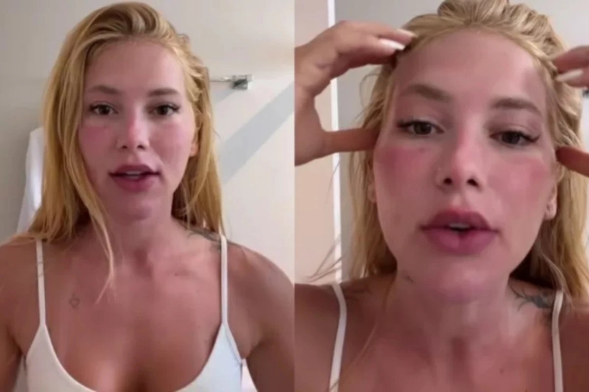Virginia Fonseca exibe rosto avermelhado apos acordar e revela motivo