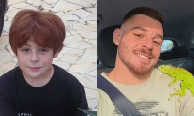ex ator mirim da Globo revela como acidente aos 13 anos.webp