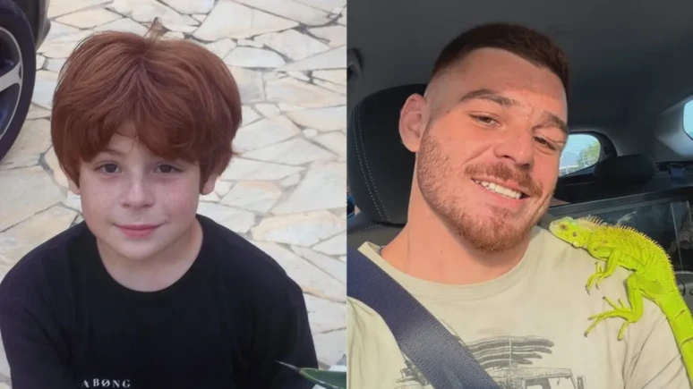 ex ator mirim da Globo revela como acidente aos 13 anos.webp