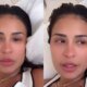 Apos passar por cirurgia Simone Mendes desabafa ‘Preciso acreditar que
