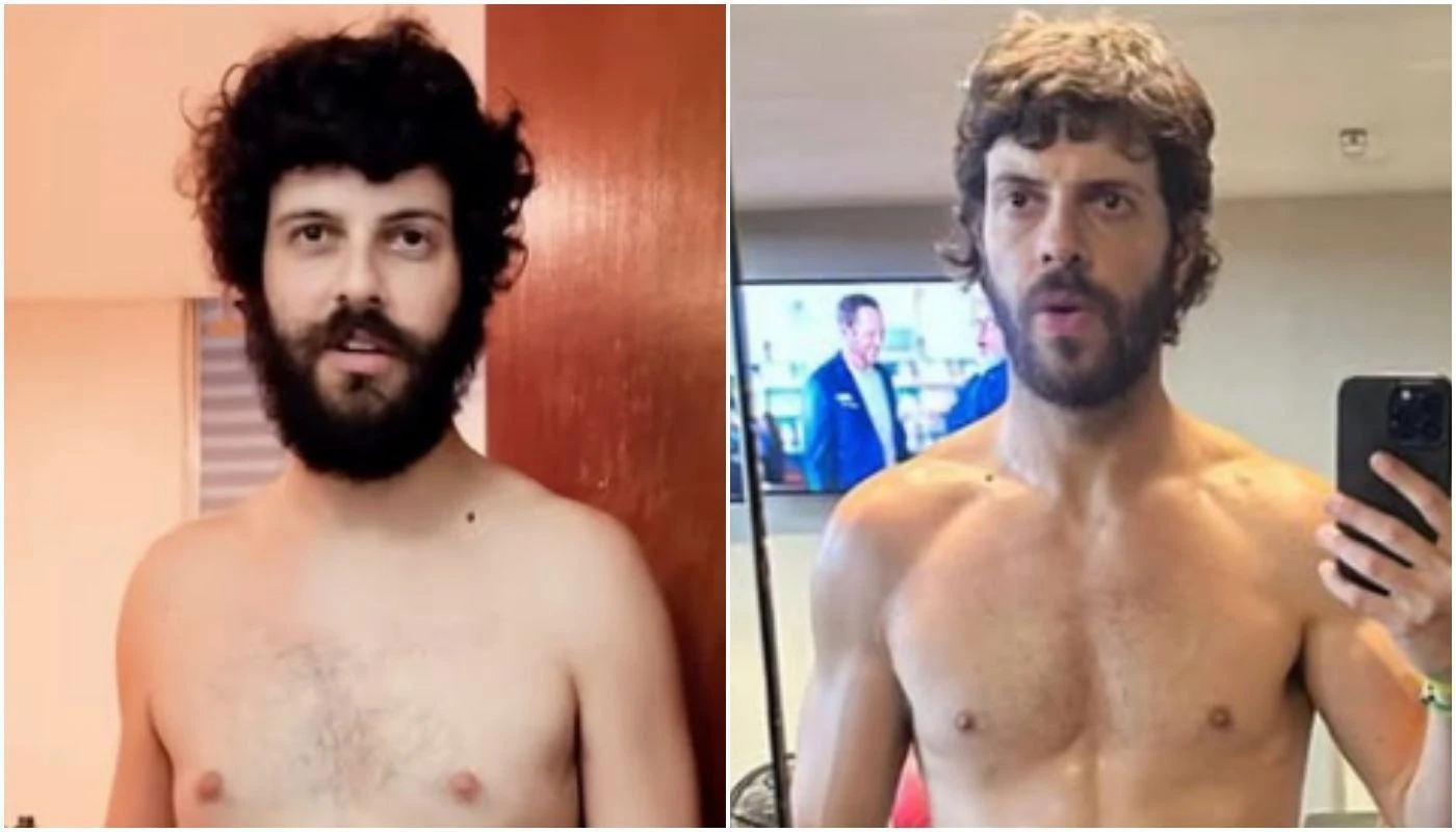 Diogo Defante mostra transformacao fisica apos retirada de tumor.webp