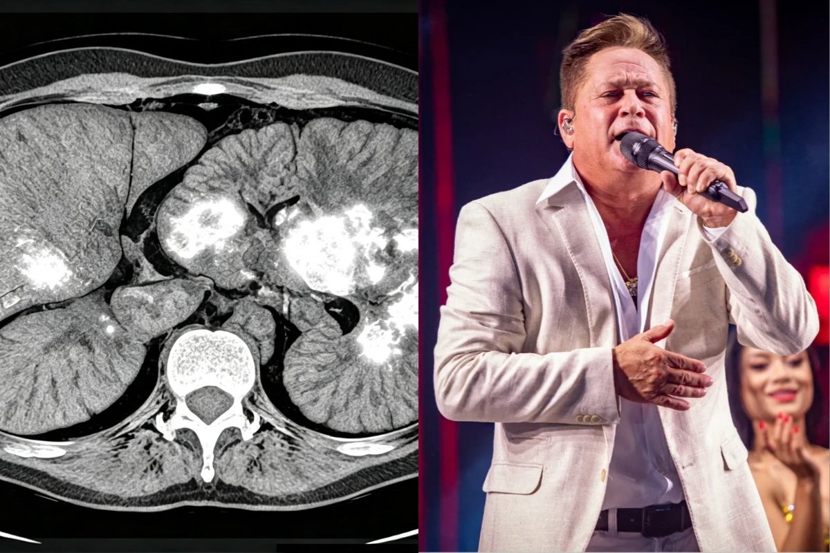Esta e a questao de saude que Leonardo enfrenta cantor