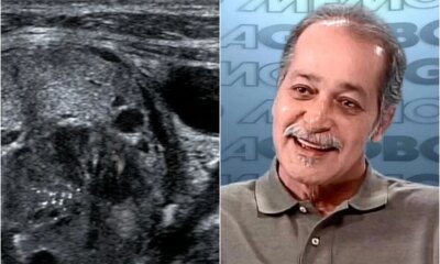 Esta foi a causa da morte do ator Gracindo Jr