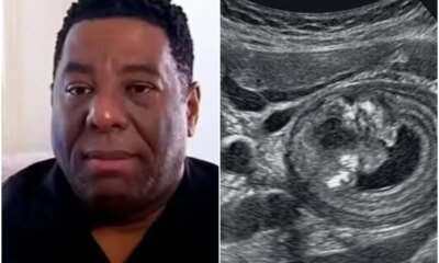 Este e o cancer diagnosticado em Netinho de Paula decisoes