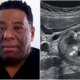 Este e o cancer diagnosticado em Netinho de Paula decisoes