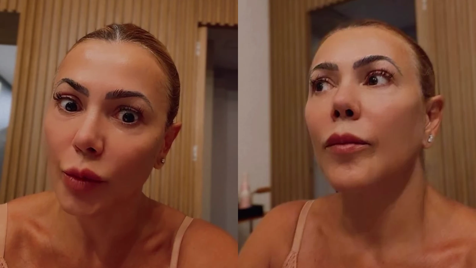 Ex BBB fala sobre descoberta de cisto no cerebro Entrei.webp