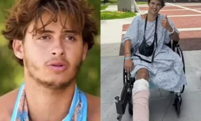 Participante perde a perna durante gravacoes de reality e pede