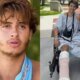 Participante perde a perna durante gravacoes de reality e pede