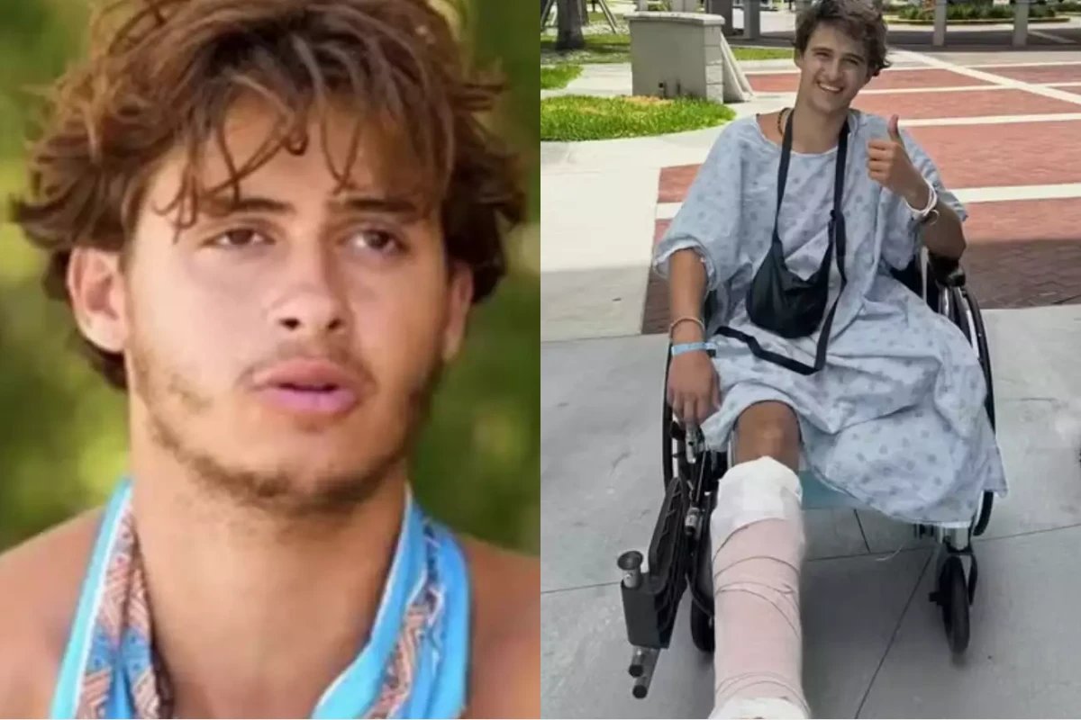 Participante perde a perna durante gravacoes de reality e pede