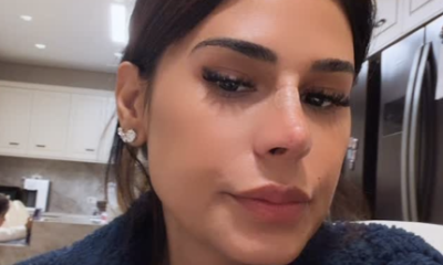 Rinoplastia Simone Mendes explica mudanca no nariz e revela procedimento