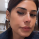 Rinoplastia Simone Mendes explica mudanca no nariz e revela procedimento