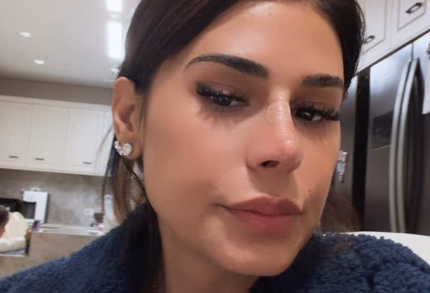 Rinoplastia Simone Mendes explica mudanca no nariz e revela procedimento