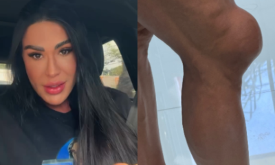 Gracyanne Barbosa revela drama fisico e emocional para seguir no