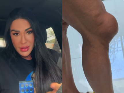 Gracyanne Barbosa revela drama fisico e emocional para seguir no